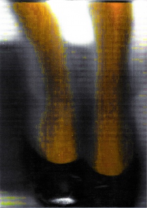 Rachel Louise Hodgson 2